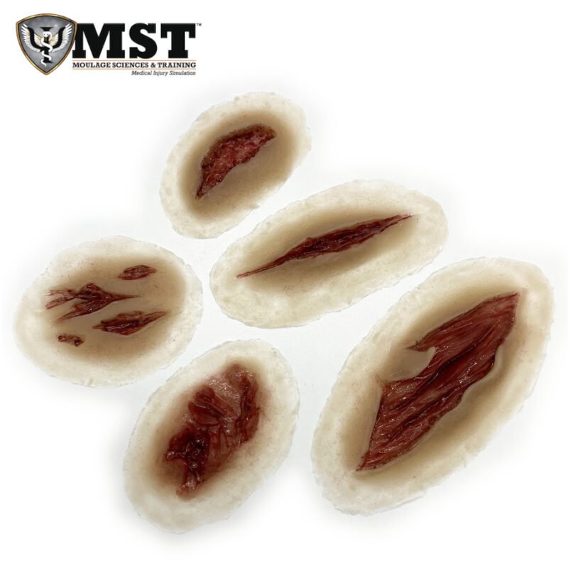 Moulage - Laceraciones básicas