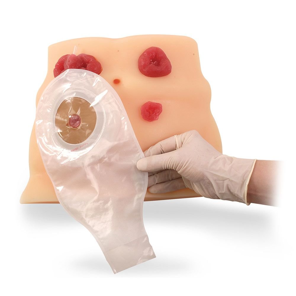 Modelo de cuidado de ostomía de Health Edco